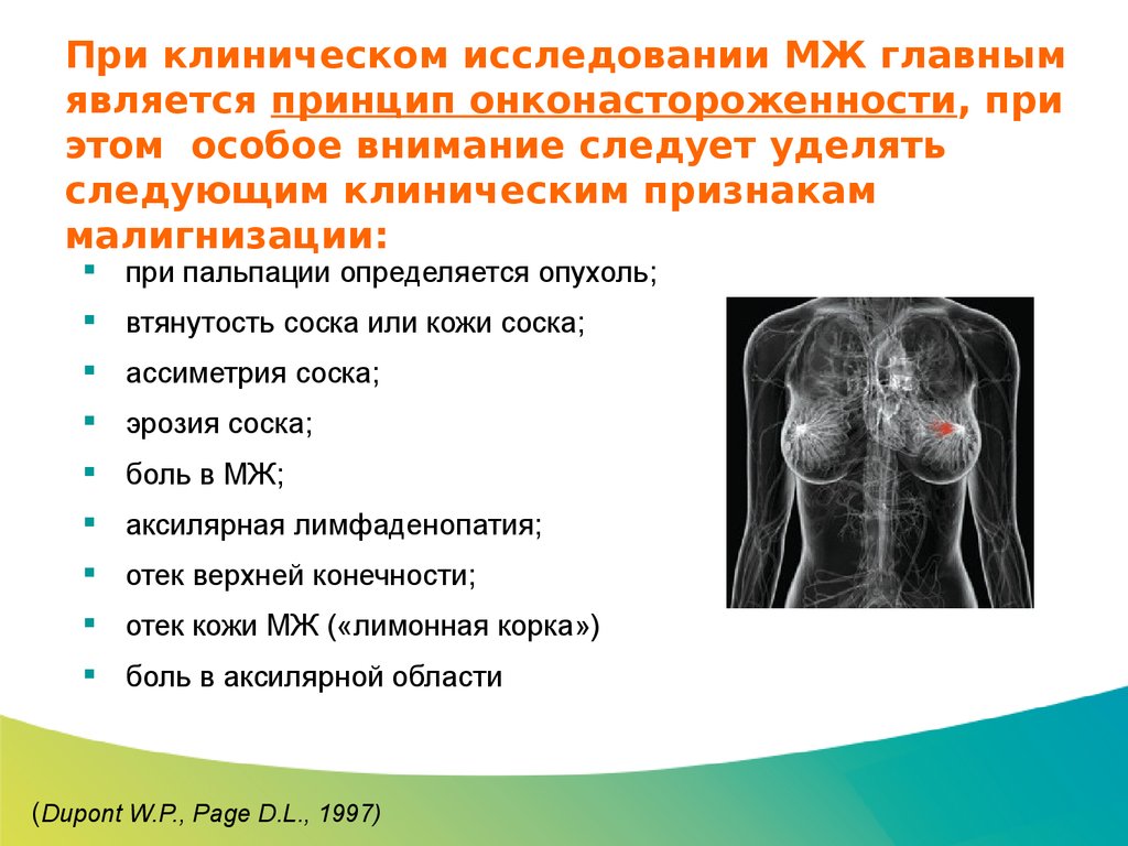 Признаки рака железы. Симптомы болезни груди.