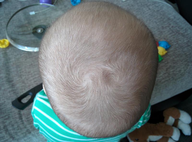 Родничок как выглядит. Две макушки на голове у ребенка. Волосы у новорожденных на голове. Затылочные Бугры на голове.