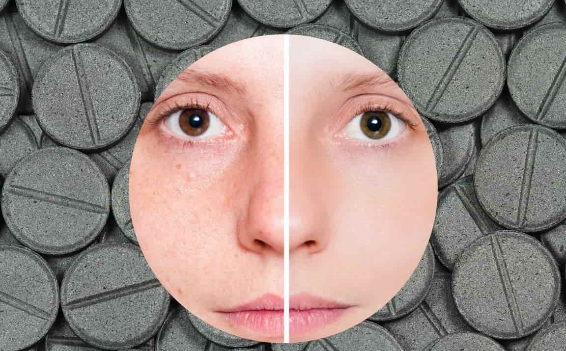 Влияние активированного угля на кожу лица
