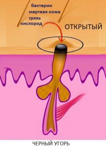 Процесс формирования черного угря