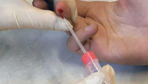 Процедура забора капиллярной крови для определения уровня глюкозы