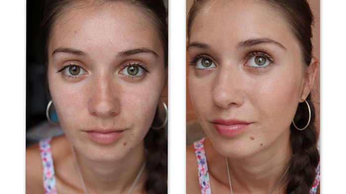 Фото до и после механической чистки лица