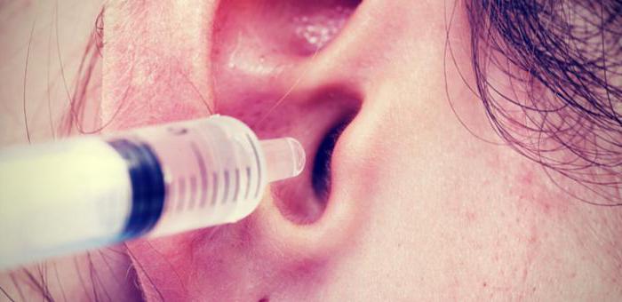 Как убрать пробку из уха в домашних условиях?