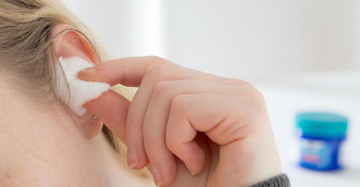 Как часто можно промывать уши перекисью водорода?
