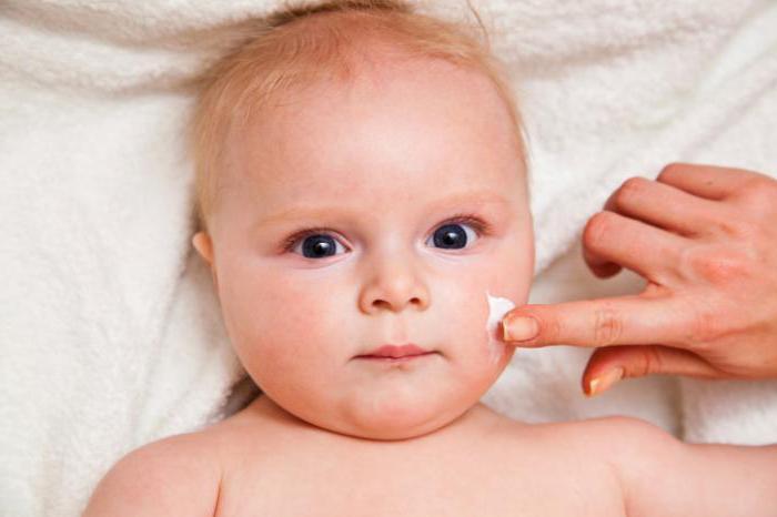 диатез у детей на лице как лечить