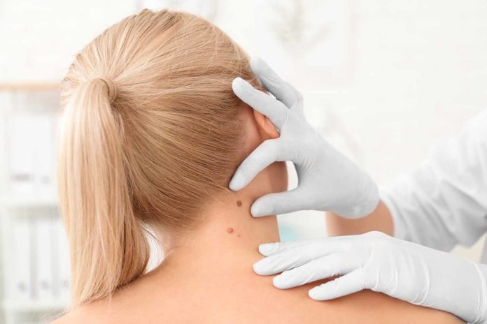 врач осматривает рак кожи на шее