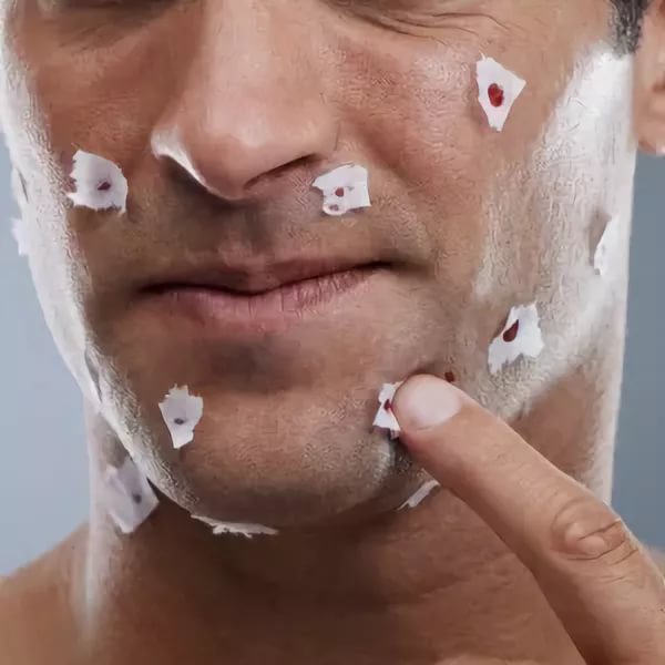 Порезы во время бритья