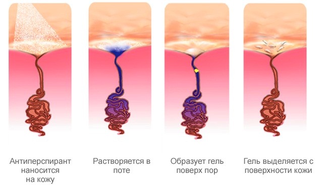 Сильное потоотделение у мужчин. Причины по ночам, на лице, подмышками, всего тела, во время сна, тренировки, после еды. Лечение, народные средства