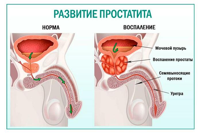 Дубовая кора. Лечебные свойства, рецепты применения для мужчин, женщин. Противопоказания