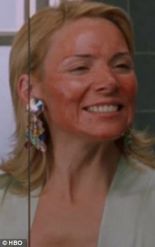 Famous pain: Kim Cattrall as Samantha Jones on famous Noughties show Sex And The City after having a chemical face peel