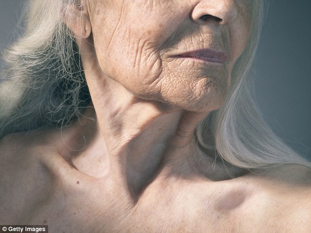 Recently, I have noticed the wrinkles on my neck look deeper, says a reader (stock image)