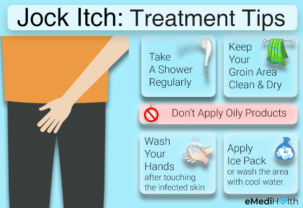 Treatment of Jock Itch