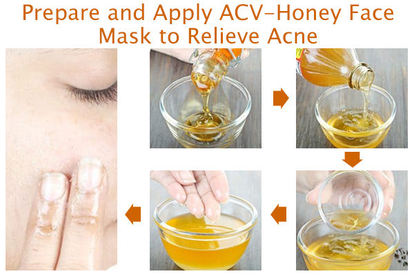 ACV-Honey Face mask for acne preparation and application