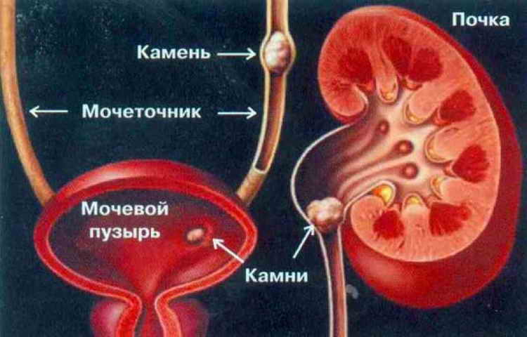 боль внизу живота слева у женщин