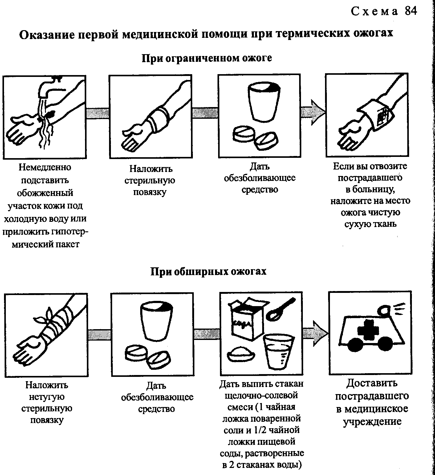 Оказание первой помощи при термических ожогах презентация