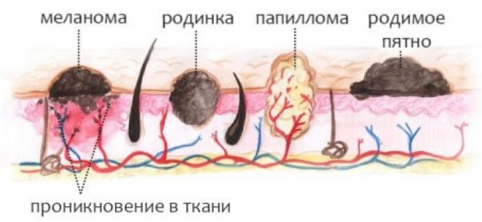 Проникновение папилломавируса в ткань