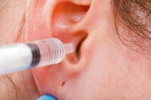 Как использовать перекись водорода для промывания уха