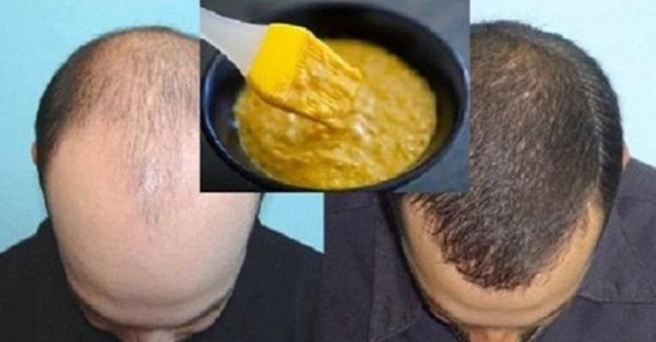 Как правильно ускорить рост волос на голове мужчине