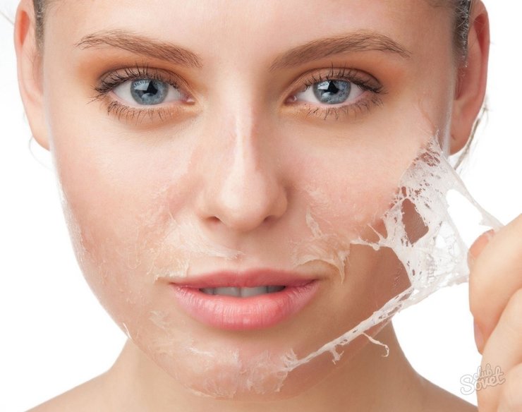 Какой выбрать крем от шелушения кожи на лице?