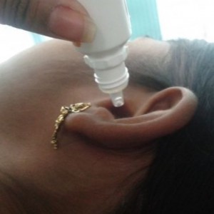 Как закапывать капли в ухо: схема, фото