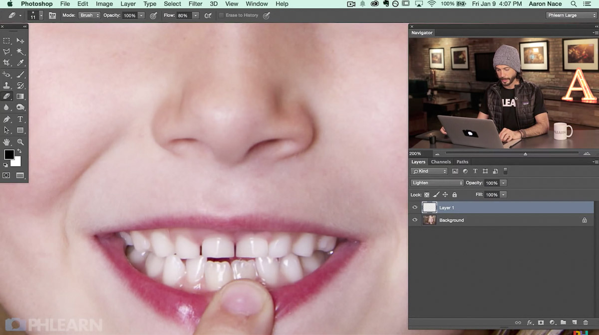 tutorial missing tooth replacement