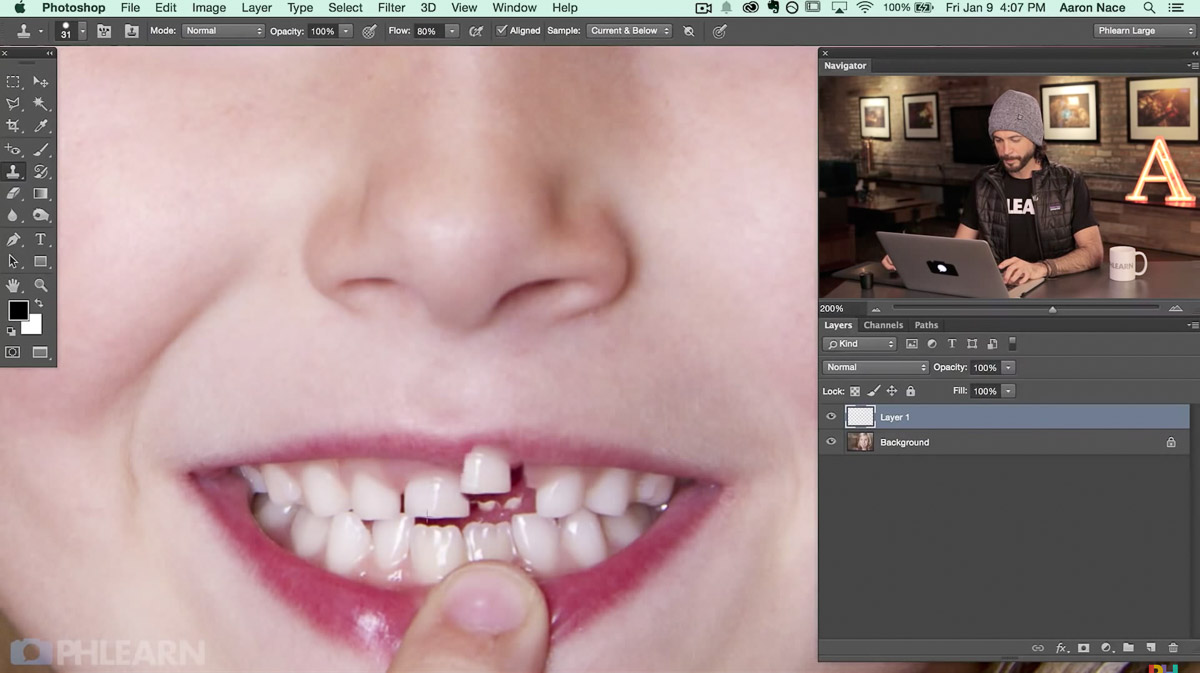 photoshop replace missing tooth 