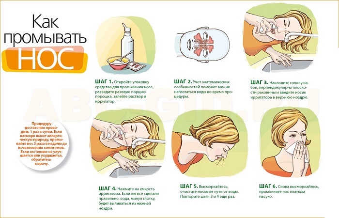 Схема -как промывать нос
